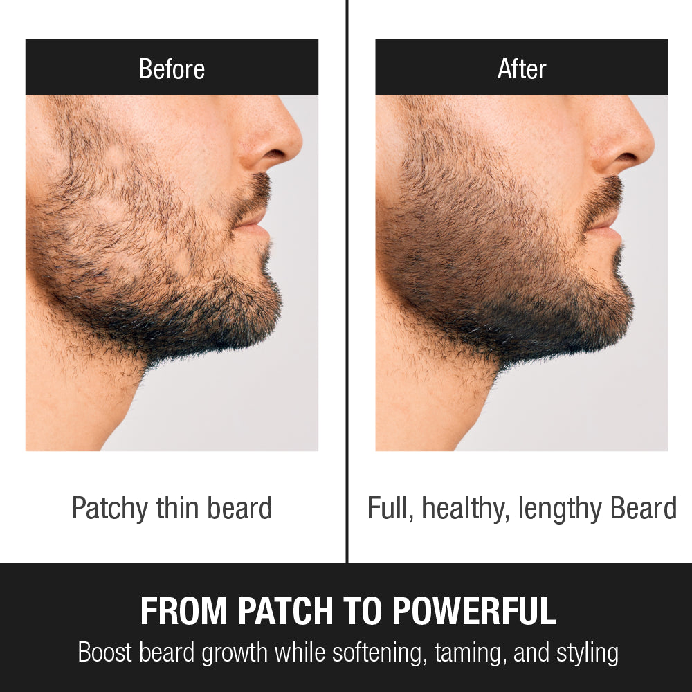 Man applying GROOMANE Beard Growth Oil to beard
